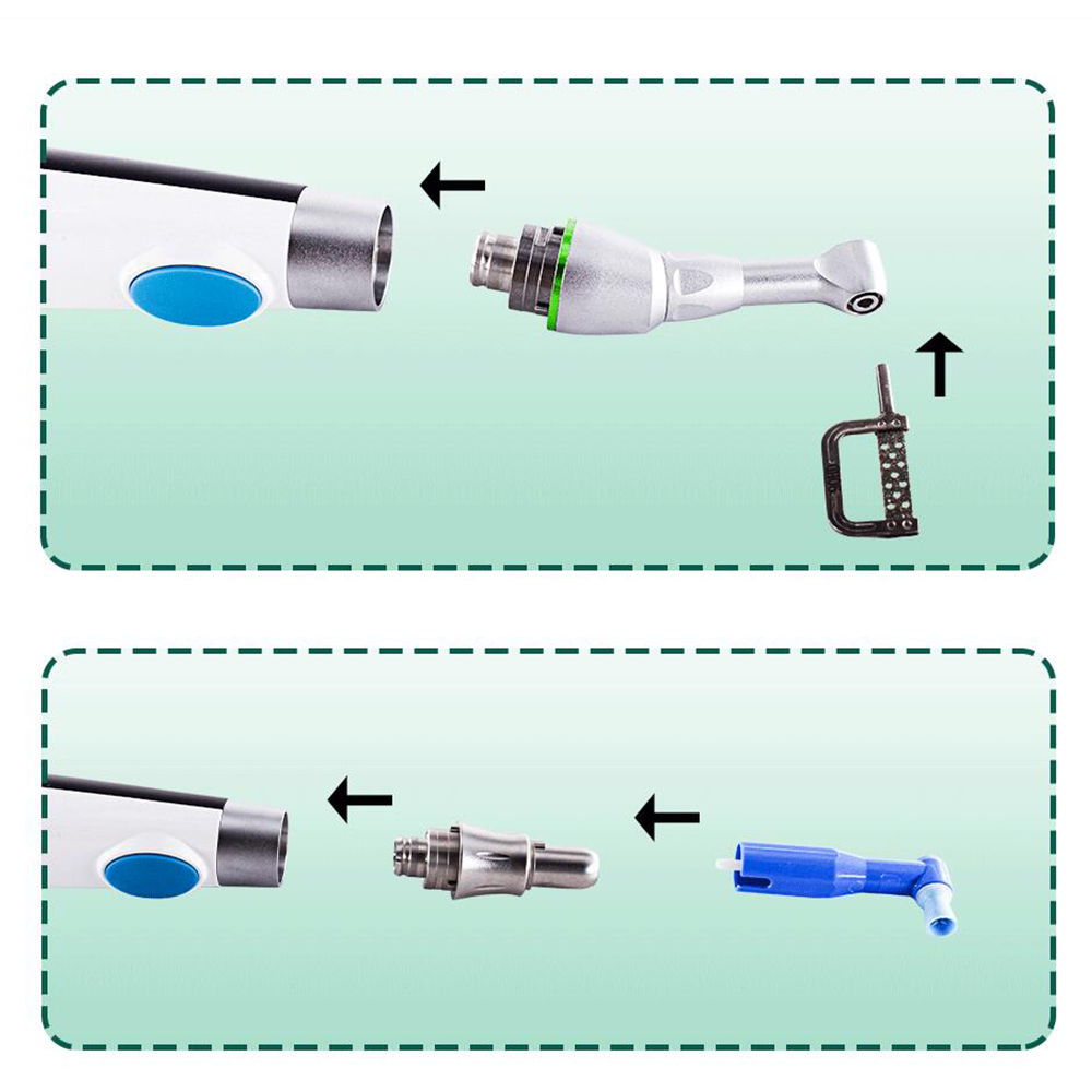 Westcode Dental Interproximal Reduction IPR & Polishing 2-in-1 Motor